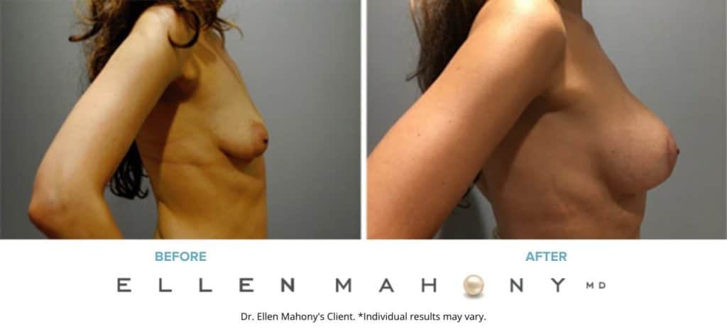 Before and After Image: Case #7206 - right-side