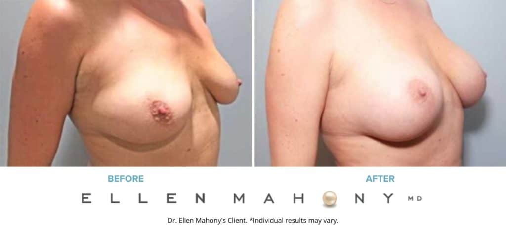 Before and After Image: Case #7387 - right-front-oblique
