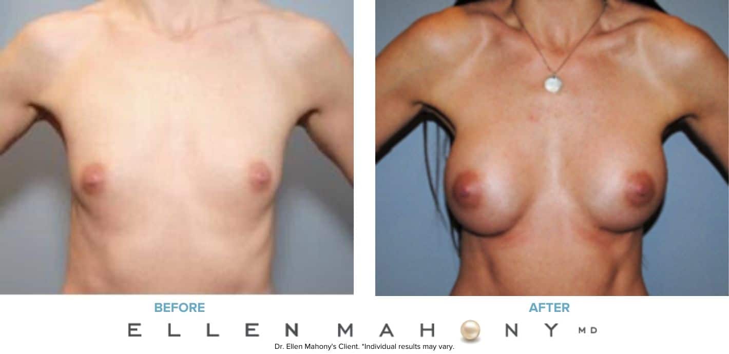 Before and After Image: Case #7571 - front
