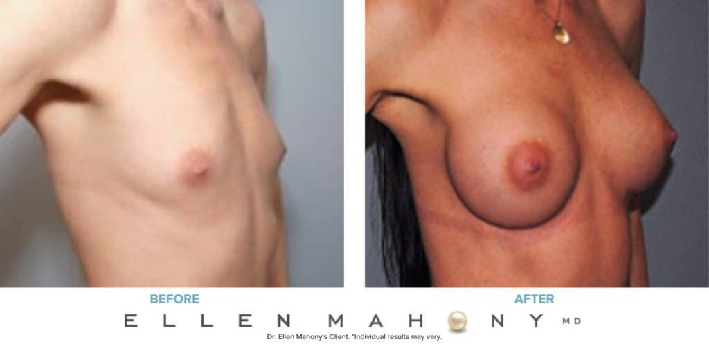 Before and After Image: Case #7571 - right-front-oblique