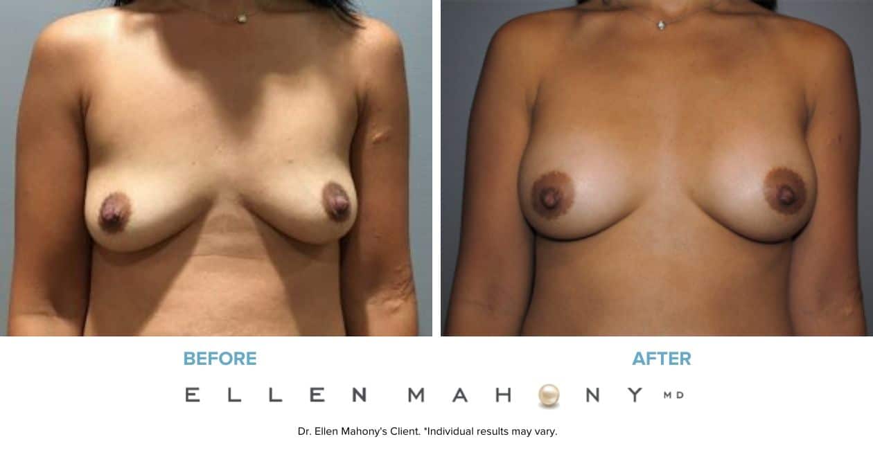 Before and After Image: Case #7750 - front