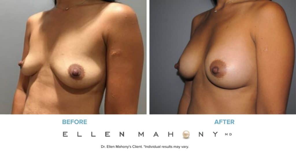 Before and After Image: Case #7750 - left-front-oblique