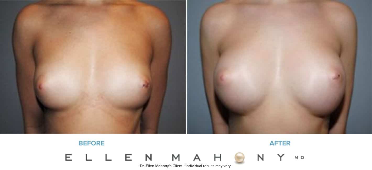 Before and After Image: Case #7898 - front