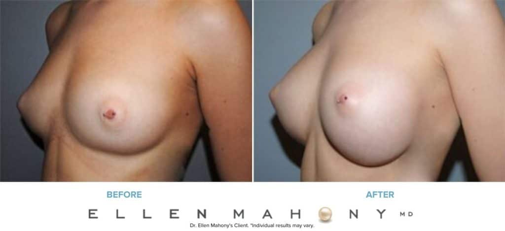 Before and After Image: Case #7898 - left-front-oblique