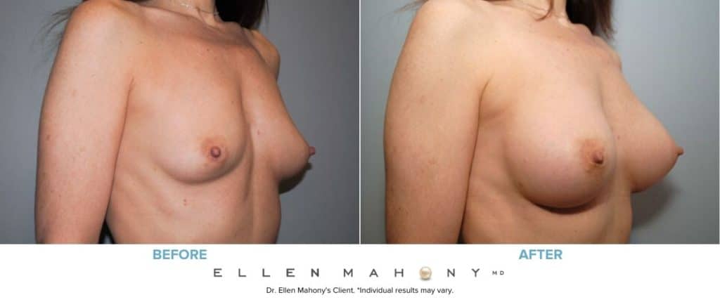 Before and After Image: Case #8040 - right-front-oblique