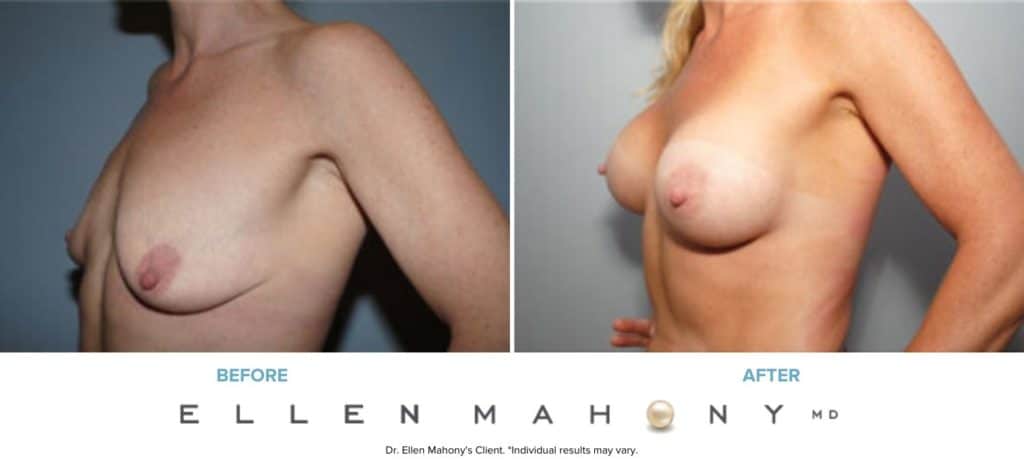 Before and After Image: Case #8048 - left-front-oblique