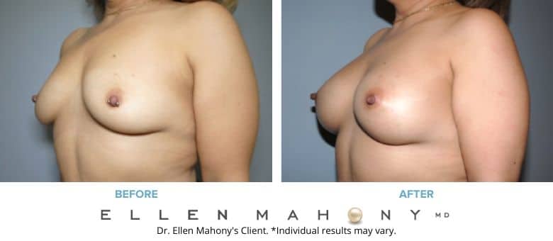 Before and After Image: Case #8751 - left-front-oblique