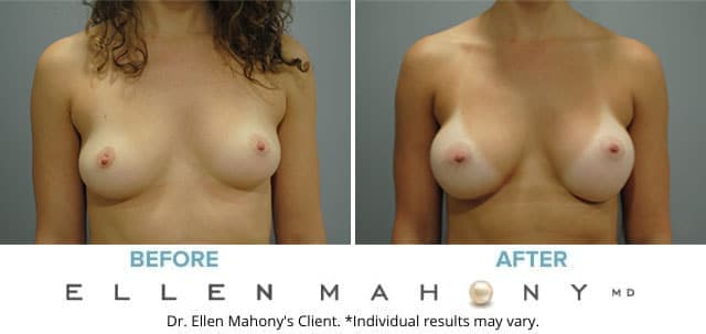 Before and After Image: Case #7789 - front