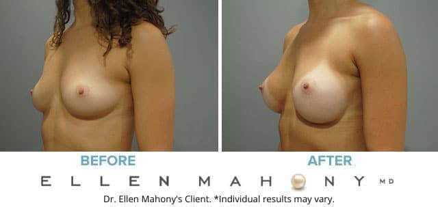 Before and After Image: Case #7789 - left-front-oblique