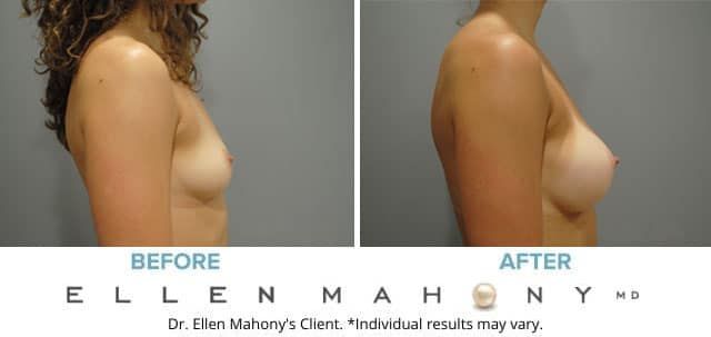 Before and After Image: Case #7789 - right-side