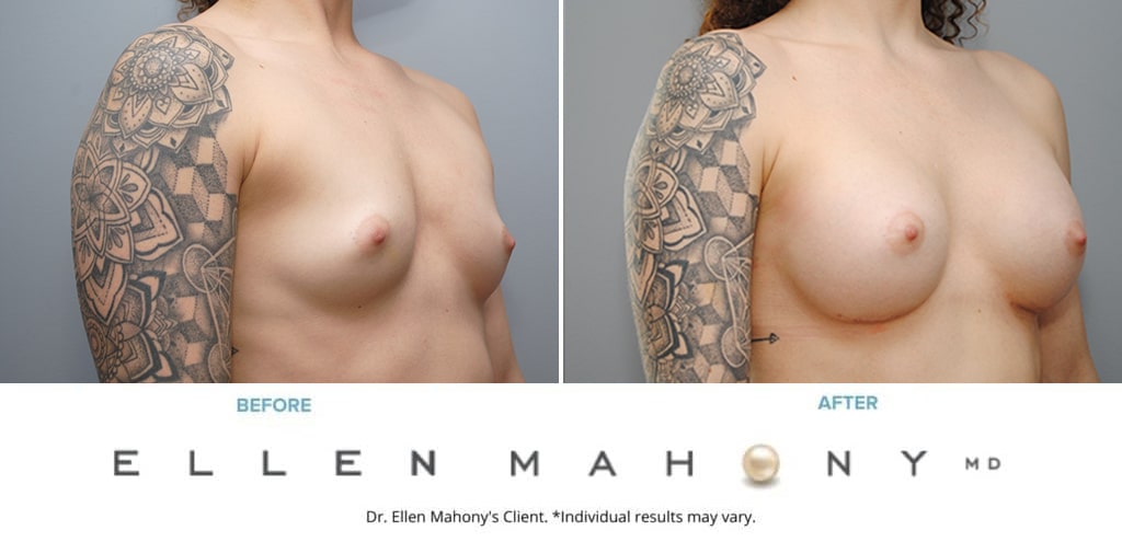 Before and After Image: Case #9088 - right-front-oblique