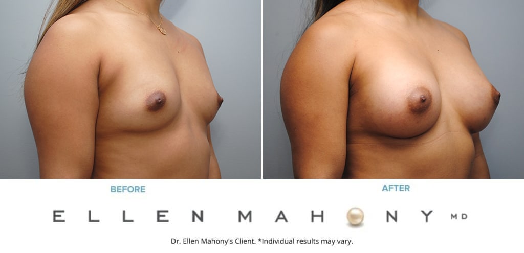 Before and After Image: Case #9331 - right-front-oblique