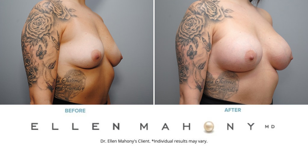 Before and After Image: Case #9355 - right-front-oblique