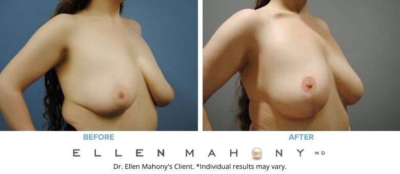 Before and After Image: Case #2664 - right-front-oblique