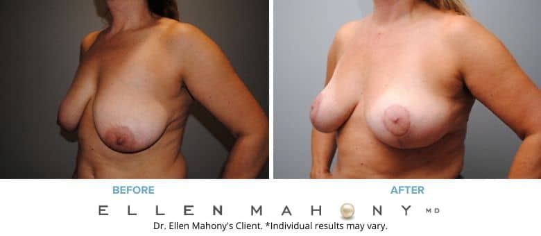 Before and After Image: Case #2678 - left-front-oblique
