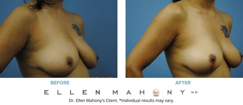 Before and After Image: Case #2706 - right-front-oblique