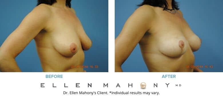 Before and After Image: Case #2711 - right-front-oblique