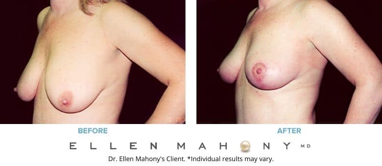 Before and After Image: Case #2723 - left-front-oblique