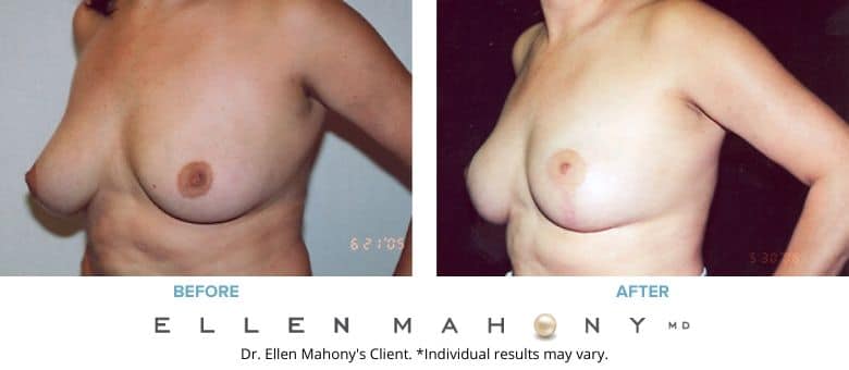Before and After Image: Case #2730 - left-front-oblique