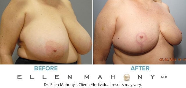 Before and After Image: Case #7094 - right-front-oblique