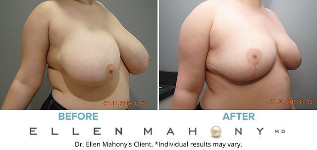 Before and After Image: Case #7882 - right-front-oblique