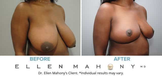 Before and After Image: Case #7887 - right-front-oblique