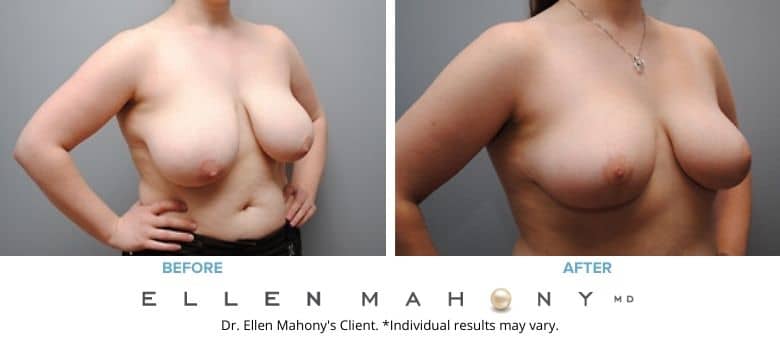 Before and After Image: Case #2563 - right-front-oblique