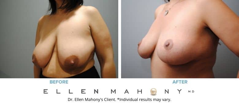 Before and After Image: Case #2577 - left-front-oblique