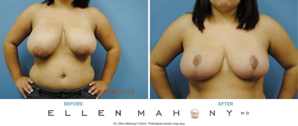 Before and After Image: Case #2629 - front