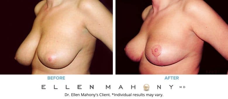 Before and After Image: Case #2643 - left-front-oblique