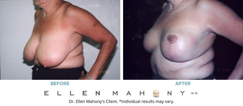 Before and After Image: Case #2650 - left-front-oblique