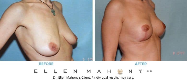 Before and After Image: Case #2657 - right-front-oblique