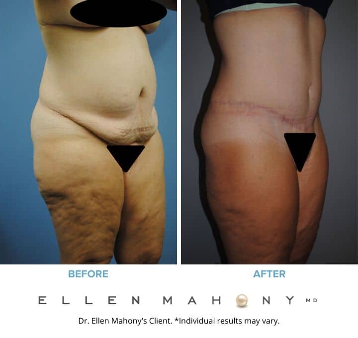 Before and After Image: Case #2120 - right-front-oblique