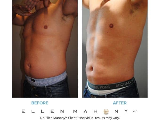 Before and After Image: Case #2186 - left-front-oblique