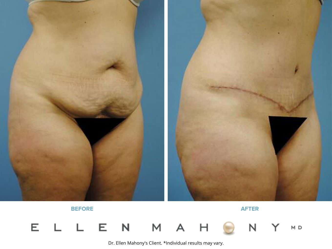 Before and After Image: Case #2293 - right-front-oblique