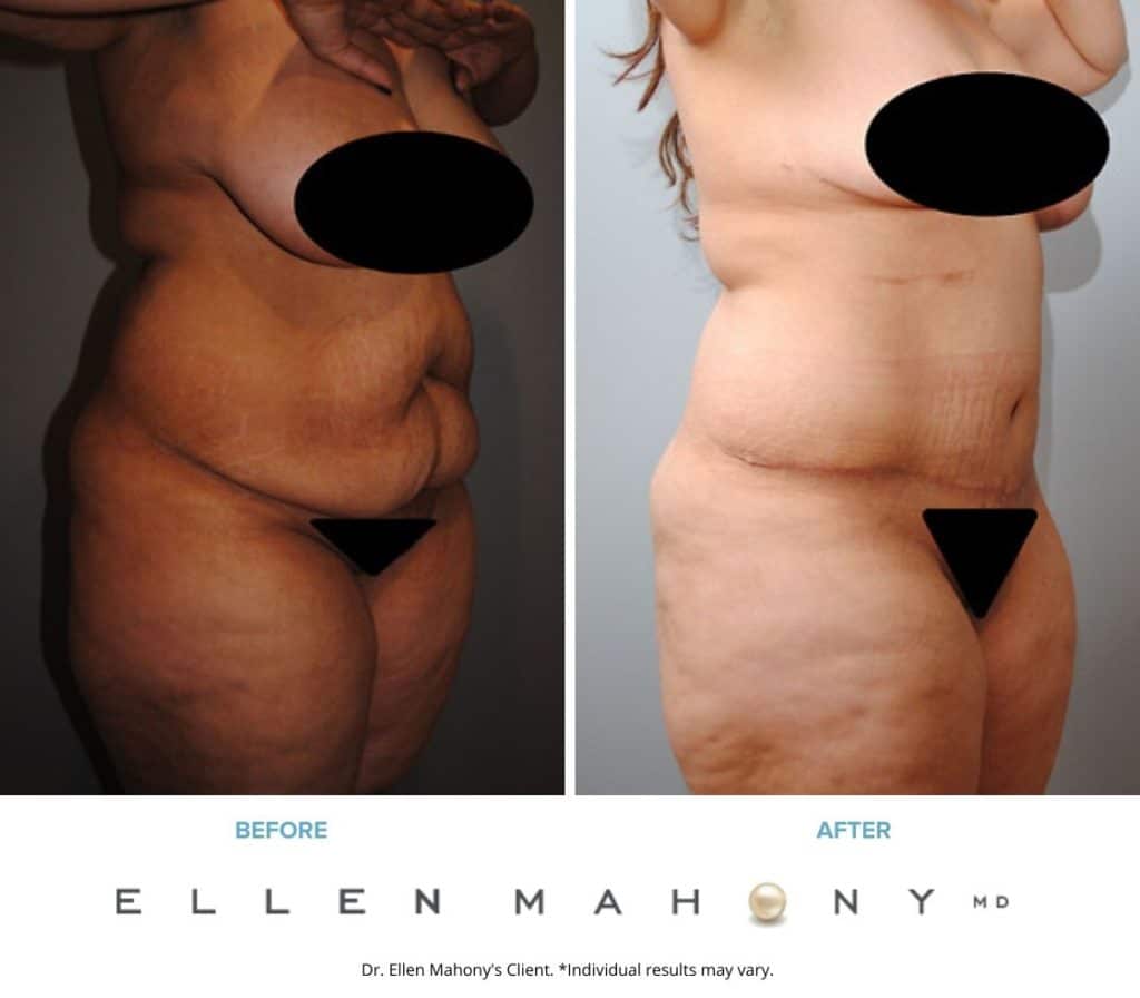 Before and After Image: Case #2400 - right-front-oblique