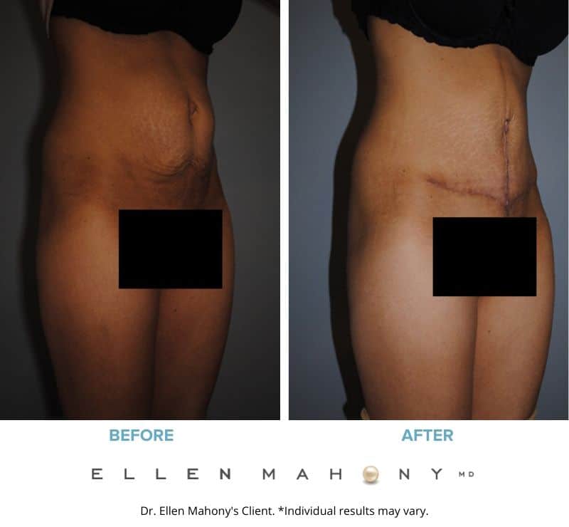 Before and After Image: Case #2407 - right-front-oblique