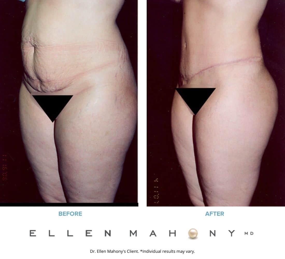 Before and After Image: Case #2431 - left-front-oblique