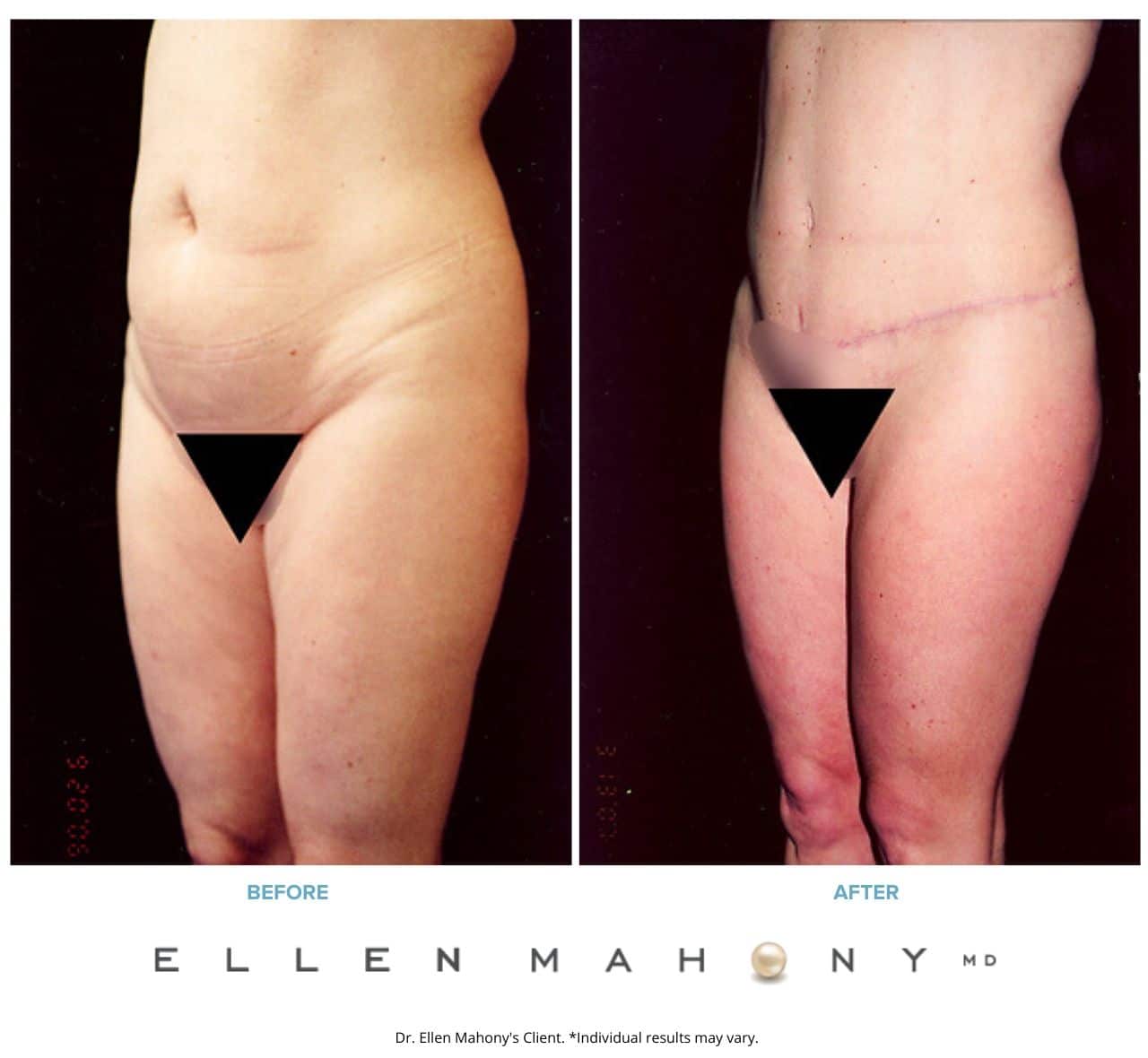 Before and After Image: Case #2512 - left-front-oblique