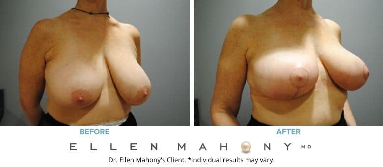 Before and After Image: Case #2584 - right-front-oblique