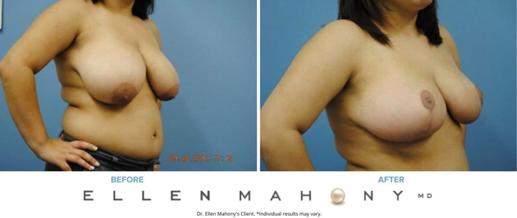 Before and After Image: Case #2629 - right-front-oblique