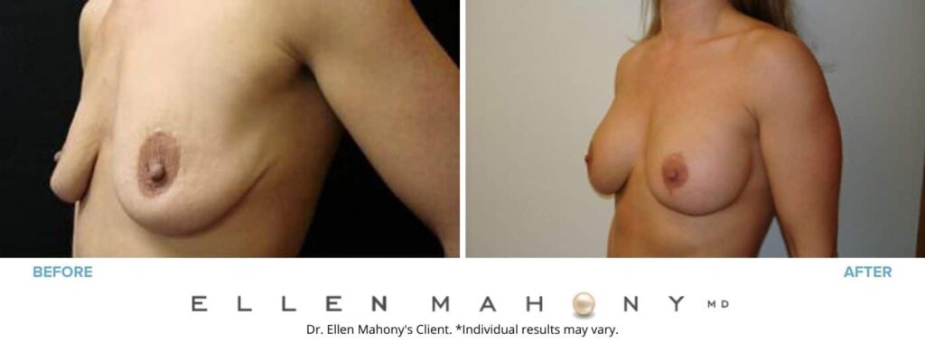 Before and After Image: Case #2696 - left-front-oblique