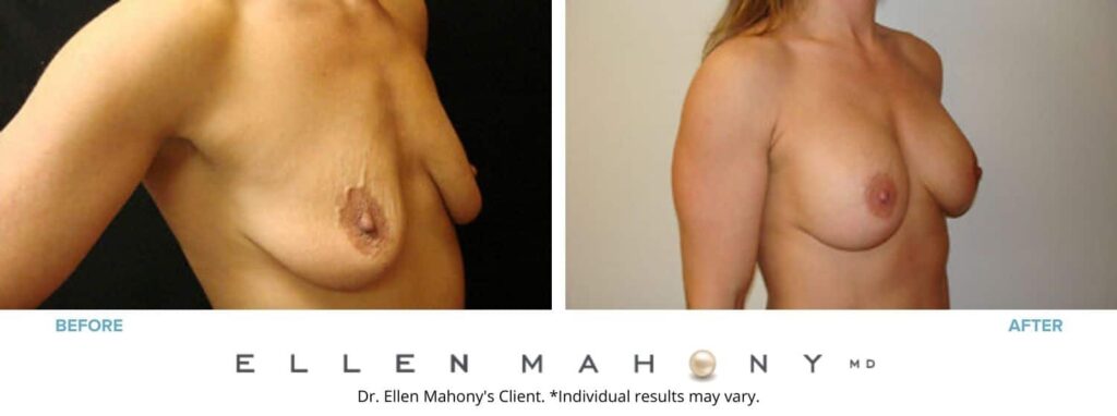 Before and After Image: Case #2821 - right-front-oblique