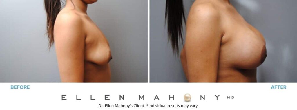 Before and After Image: Case #2847 - right-side