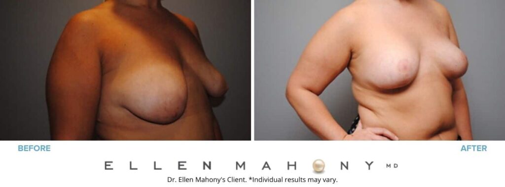 Before and After Image: Case #2854 - right-front-oblique