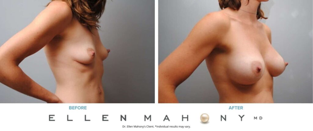 Before and After Image: Case #2891 - right-front-oblique