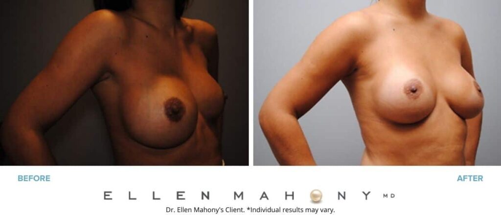 Before and After Image: Case #2959 - right-front-oblique
