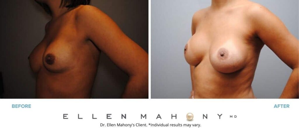Before and After Image: Case #2959 - left-front-oblique