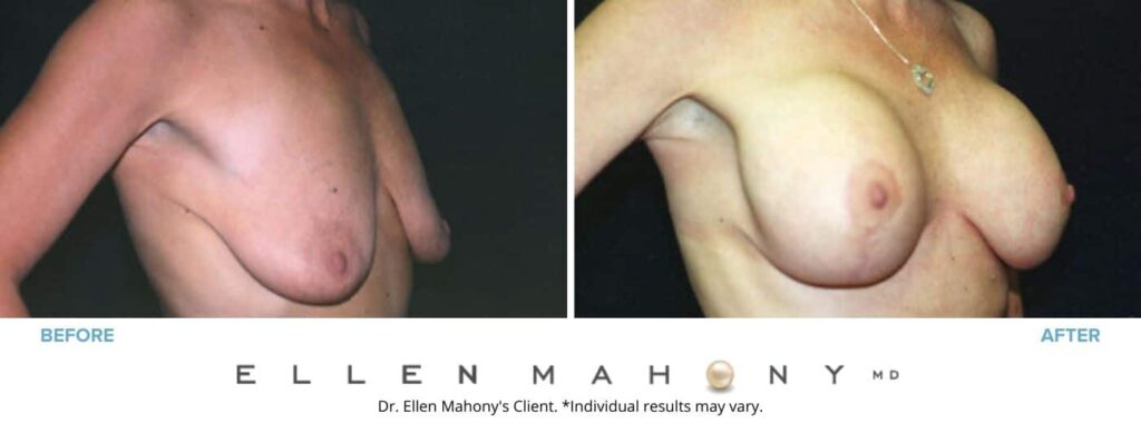 Before and After Image: Case #3167 - right-front-oblique