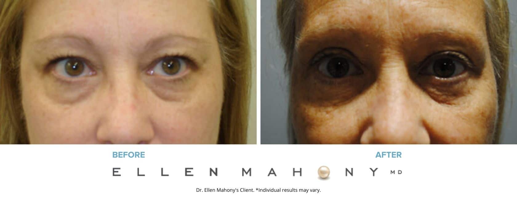 Before and After Image: Case #3270 - front
